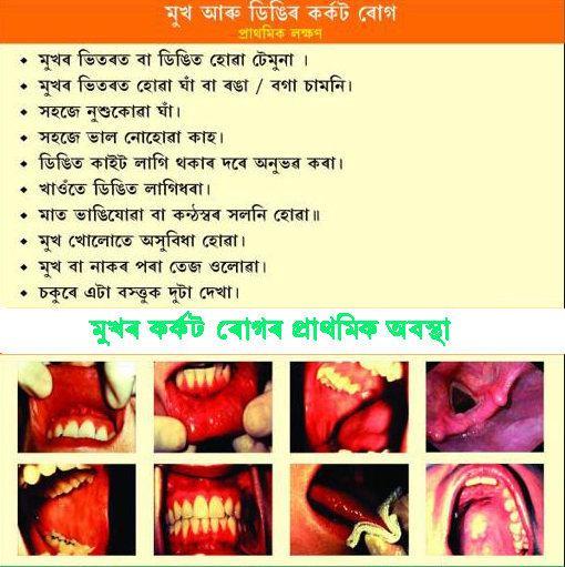 কৰ্কট ৰোগৰ কেইটামান প্ৰাথমিক লক্ষণ