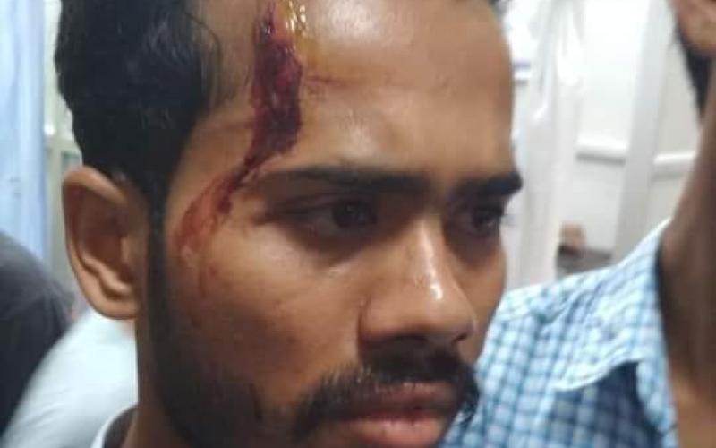 প্ৰাক্-নিৰ্বাচনী হিংসাত কটন বিশ্ববিদ্যালয়ৰ ২ ছাত্ৰ আহত