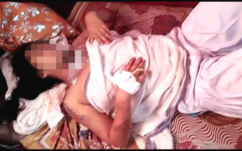 নাৰায়ণপুৰৰ পথালিপাহাৰত এচিড ঢালি কলেজীয়া ছাত্রীক আক্ৰমণ