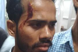 প্ৰাক্‌-নিৰ্বাচনী হিংসাত কটন বিশ্ববিদ্যালয়ৰ ২ ছাত্ৰ আহত